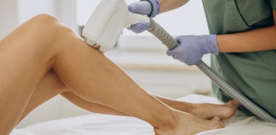 depilacja laserowa